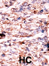 PSKH1 Antibody