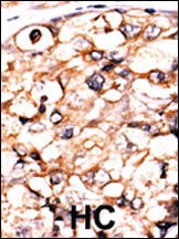 PGK2 Antibody