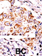 NME3 Antibody