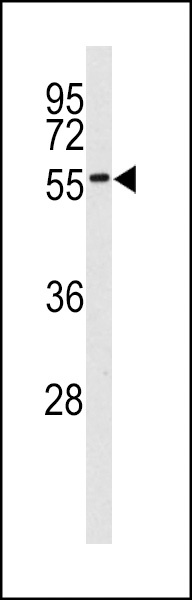 MNK2 Antibody