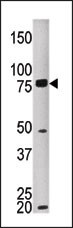 MELK Antibody