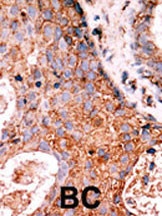 LMTK2 Antibody