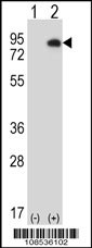 HIPK4 Antibody