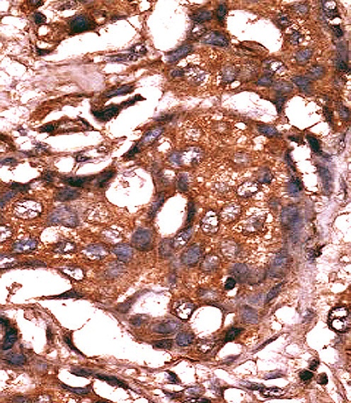 Guanylyl Cyclase alpha 1 Antibody