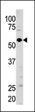 Guanylyl Cyclase alpha 1 Antibody