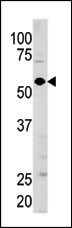 GUCY1A3 Antibody