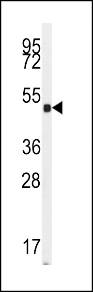 GUCY1A2 Antibody