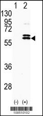 CDKL2 Antibody