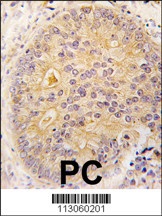 CAMKK2 Antibody