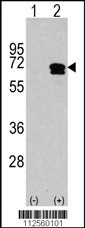 CAMKK2 Antibody