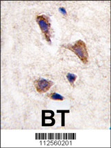 CAMKK2 Antibody