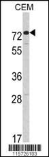 AMHR2 Antibody