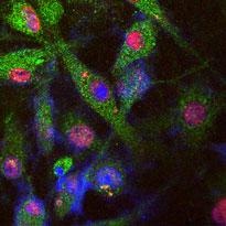 PARK8 Antibody