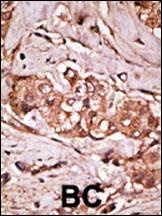 PARK8 Antibody