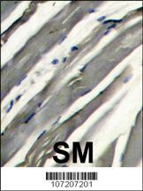 PARK8 Antibody