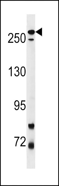 PARK8 Antibody
