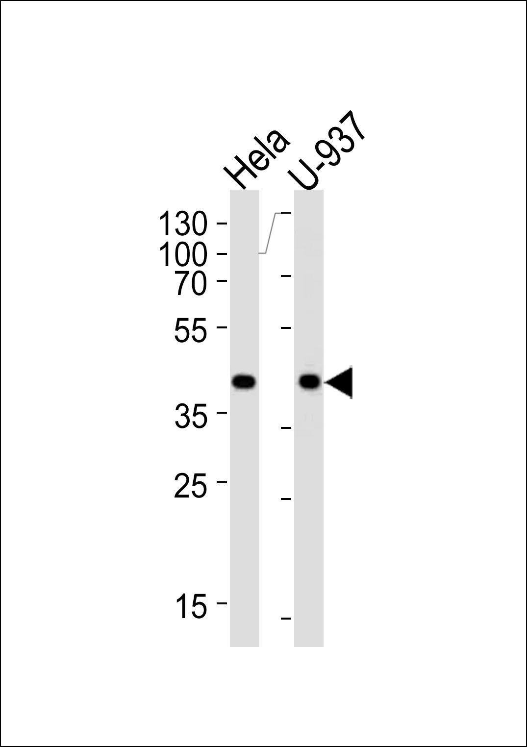 PGK1 Antibody