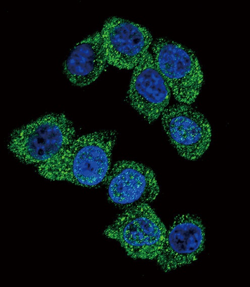 PGK1 Antibody