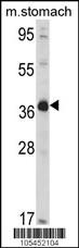 NAGK Antibody