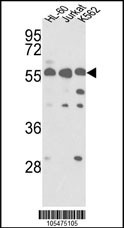 PICK1 Antibody