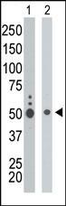 UHMK1 Antibody