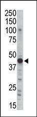 PKA 2 beta Antibody