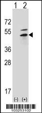 PKA 2 beta Antibody