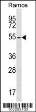 PRKAR2B Antibody