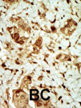 PRKAG3 Antibody