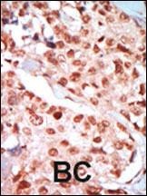 AMPK gamma Antibody