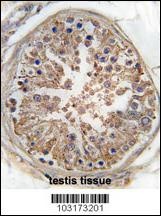 PRKAG1 Antibody