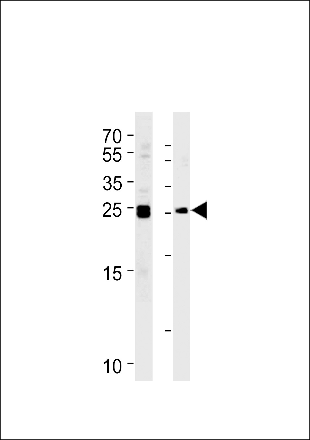 MOB4A Antibody