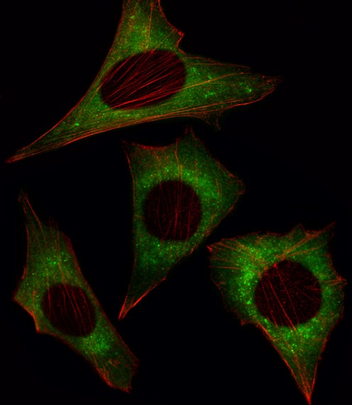 MOB1B Antibody