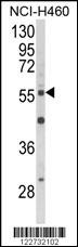 AKT2 Antibody