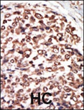 PKC nu Antibody