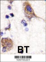 SCYL2 Antibody