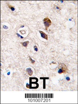 PKC gamma Antibody