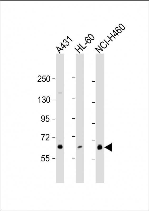 PKC eta Antibody