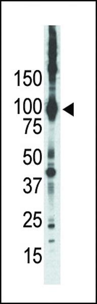 PRKCE Antibody