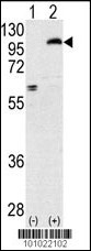 PRKCE Antibody