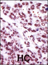 PRKCE Antibody