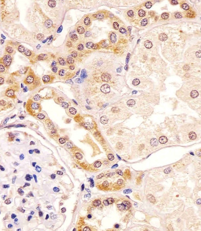 PKC beta1/2 Antibody