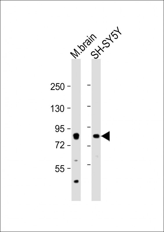 PRKCB Antibody