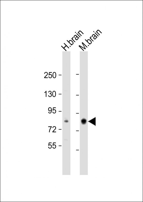 PRKCB Antibody