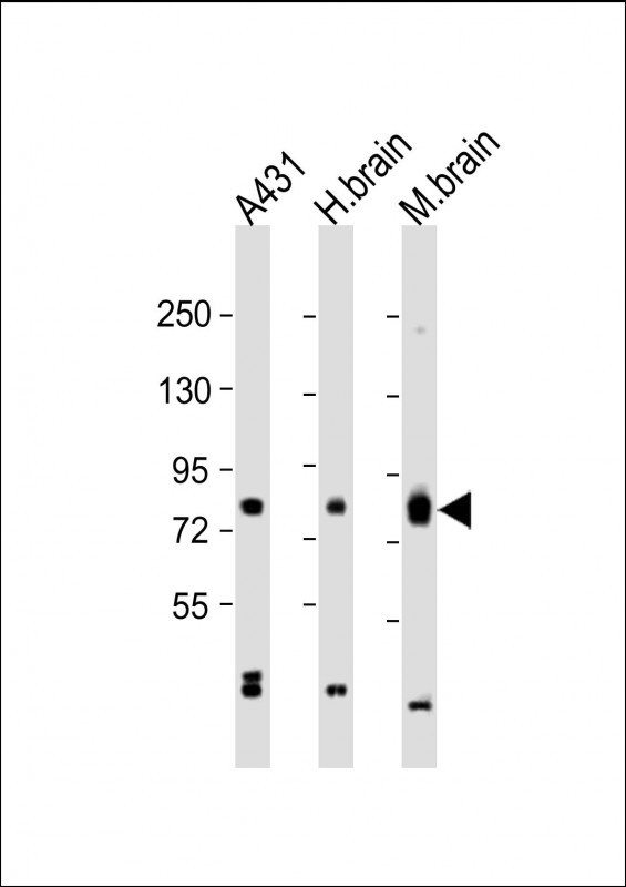 PKC beta1/2 Antibody