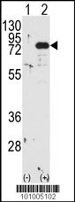 PKC beta1/2 Antibody