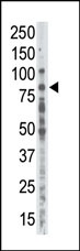 PKC alpha Antibody