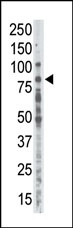 PRKCA Antibody