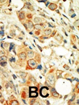 PRKCA Antibody