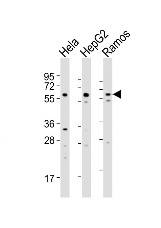 GRK5 Antibody